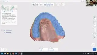Medit App Splint Designing splints with the Medit Splints app ESP