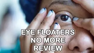 Eye Floaters No More Reviews 👀   Get Rid Of Annoying Eye Floaters 👁