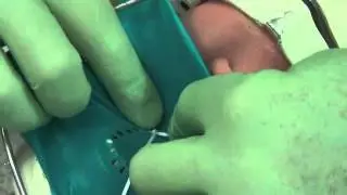 Dental rubber dam placement