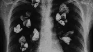 BUTTERFLIES &ndash; Lhormi Seven (PROD. BY D.T.L)