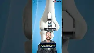 Symptoms Indicating the Need for Elbow Replacement Surgery | Dr. Debashish Chanda