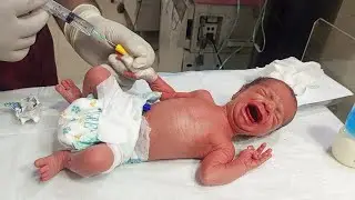 Hungry Preterm Baby with Hypoglycemia | RBS Check, Skin Care & Safe Feeding