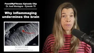 Why inflammation causes dementia &mdash; brain effects of inflammaging