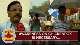 Awareness on Chickenpox is Necessary : Doctors - Thanthi TV