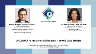 IDEF Educational Series  OPZELURA in Practice  Vitiligo Real &ndash; World Case Studies