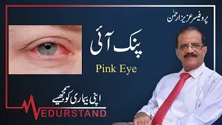 Urdu: Pink Eye پنک آئی | Punk Eye Detail View-Treatment- Prevention and Precaution | Medurstand