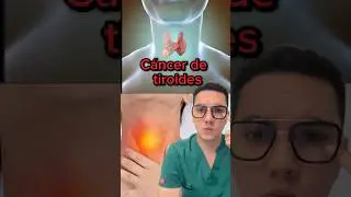 S&iacute;ntomas de alerta de c&aacute;ncer de tiroides | Dr. William Guerrero. #medicina #shorts