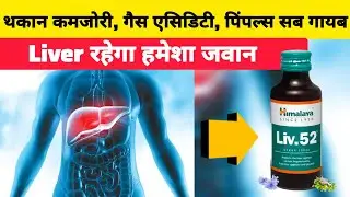 Liv 52 Syrup | क्या Fatty Liver सच में ठीक करता है? फायदे, नुकसान और सच्चाई