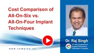 Compare cost of All-On-Six vs. All-On-Four Dental Implants | Richmond Hill