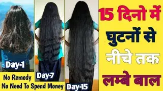 15 Days HAIR GROWTH CHALLENGE For LAZY & BUSY People | Best Hacks For Students & Working Person