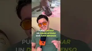 los ORNITORRINCOS son VENENOSOS