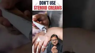 Stop Using Steroid Creams on Your Face | Hidden Dangers You Must Know