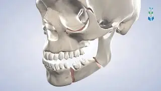 Facial Trauma in Springfield IL at Oral & Facial Surgeons of Illinois