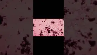 Инфузория туфелька и Эвглена зеленая в капле воды из Измайловского парка #биология #микроскоп