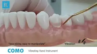 Do Fillings Faster With This