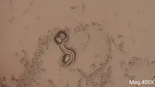 Eggs, larvae and egg with larva of parasite Microscopy live