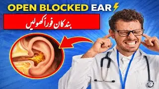 Clogged Ear? Open It INSTANTLY | ENT Doctor | کان بند ہو گیا؟ فوراً کھولیں