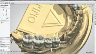 Dental System&trade; 2012 - Smile Composer