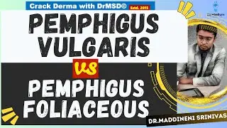 Pemphigus foliaceous Vs Pemphigus vulgaris Explained by a DERMATOLOGIST