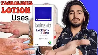 Tacrovin Forte Review | Tacrolimus Lotion Review