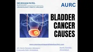 Understanding Bladder cancer Causes | The BEST Way To Prevent Bladder Cancer by Dr Rohan Patel