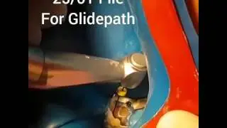 Glidepath