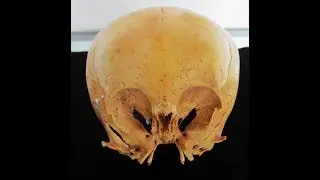 The Enigmatic Ancient Humanoid Skulls Of Paracas Peru