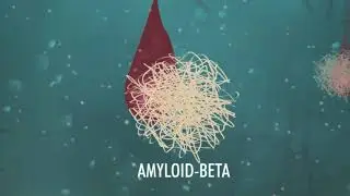 EPAD Amyloid (Deutsch)