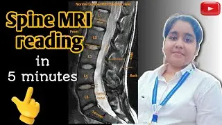 How to read Spine MRI report | Spine MRI report kaise dekhe | Spine MRI reading |