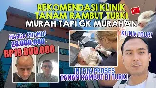 KLINIK TANAM RAMBUT DI TURKI MURAH TAPI KUALITAS MAKSIMAL! HIDDEN GEM NIH!