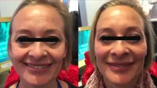 Ion Magnum IELLIOS Testimonials and Clinical Studies 2012