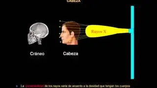 INTRODUCCION A LA RADIOLOGIA