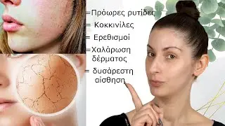 Ξηρές και αφυδατωμένες επιδερμίδες που θέλετε αντιγήρανση...θα σωθείτε ||Dimitra's beauty channel