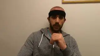 DrT Hair Transplant Turkey Clinic Patient Review....