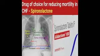 Drug of choice for cardiovascular system !! Cardiovascular system