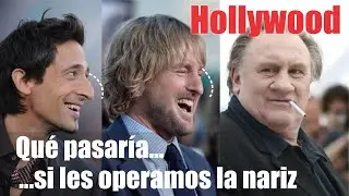 HOLLYWOOD: Cómo se verían con una RINOPLASTÍA?👃🏼Tipos de nariz  🤩 DR ALBERTO CALVO QUIROZ