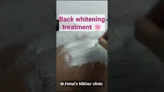 Back whitening treatment.. ✨  #lasertreatment #skincare #backwhitening #bodywhitening