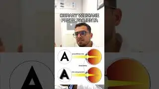 Co to jest astygmatyzm?