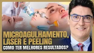 MICROAGULHAMENTO, LASER E PEELING: Como ter melhores resultados?