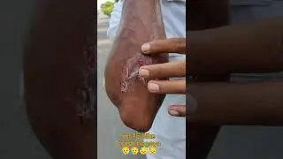 mt 15 v 2.0 bike # live crash hogeya #😭😭😥😥#mt15 bike rider #trending shorts video #viral video