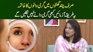 Garmi Dane Khatam Kerny ka tareeqa | Garmi Dano Ka Ilaj | Dr Batool | Herbalist Special | MasalaTv