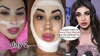 Mouni Roy Looks Unrecognizable after her shocking Plastic surgery, Lip Fillers and Botox
