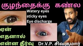 Are baby's eyes always dirty, sticky? #newborn Eye discharge,sticky eyes,watery eyes