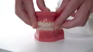 How to Apply OrVance&reg; Whitening Treatment