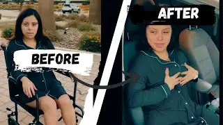 Operation Day Before and After Operation