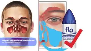 Using Flo Sinus Care in Young Children