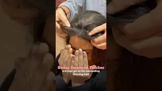 The most Viral product!! Conceals receding hairline & crown hair thinning?