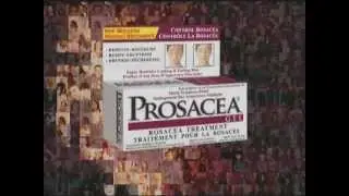 PROSACEA