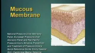 Wound Assessment and Care