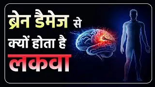लकवा का असली कारण क्या है? | Brain Damage Explained | Paralysis का असली कारण | Dr Puru Dhawan